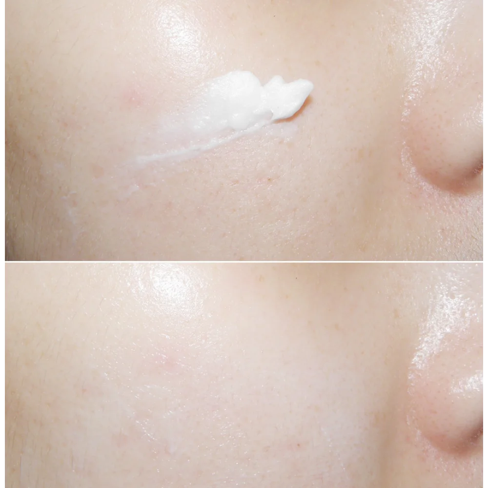 Korea Mizon Skin Recovery Nigh - Luxury Skincare Essence recension och pris
