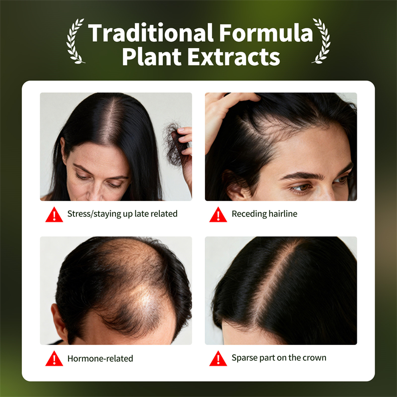Natural Hair Growth Set Usman  - Epidermal Growth Factor recension och pris
