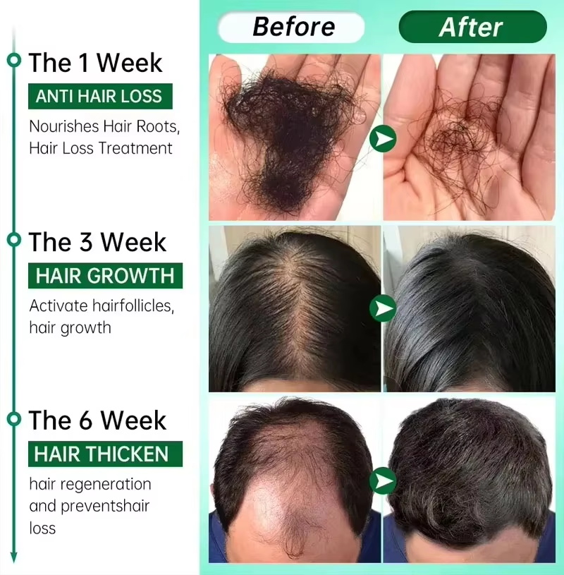 Hair Growth Serum 7 Days Fast  - Epidermal Growth Factor recension och pris
