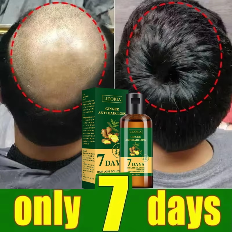 Hair Growth Serum 7 Days Fast  - Epidermal Growth Factor recension och pris