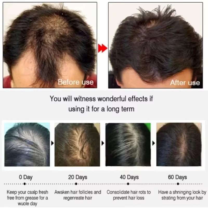 Hair Growth Serum 7 Days Fast  - Epidermal Growth Factor recension och pris