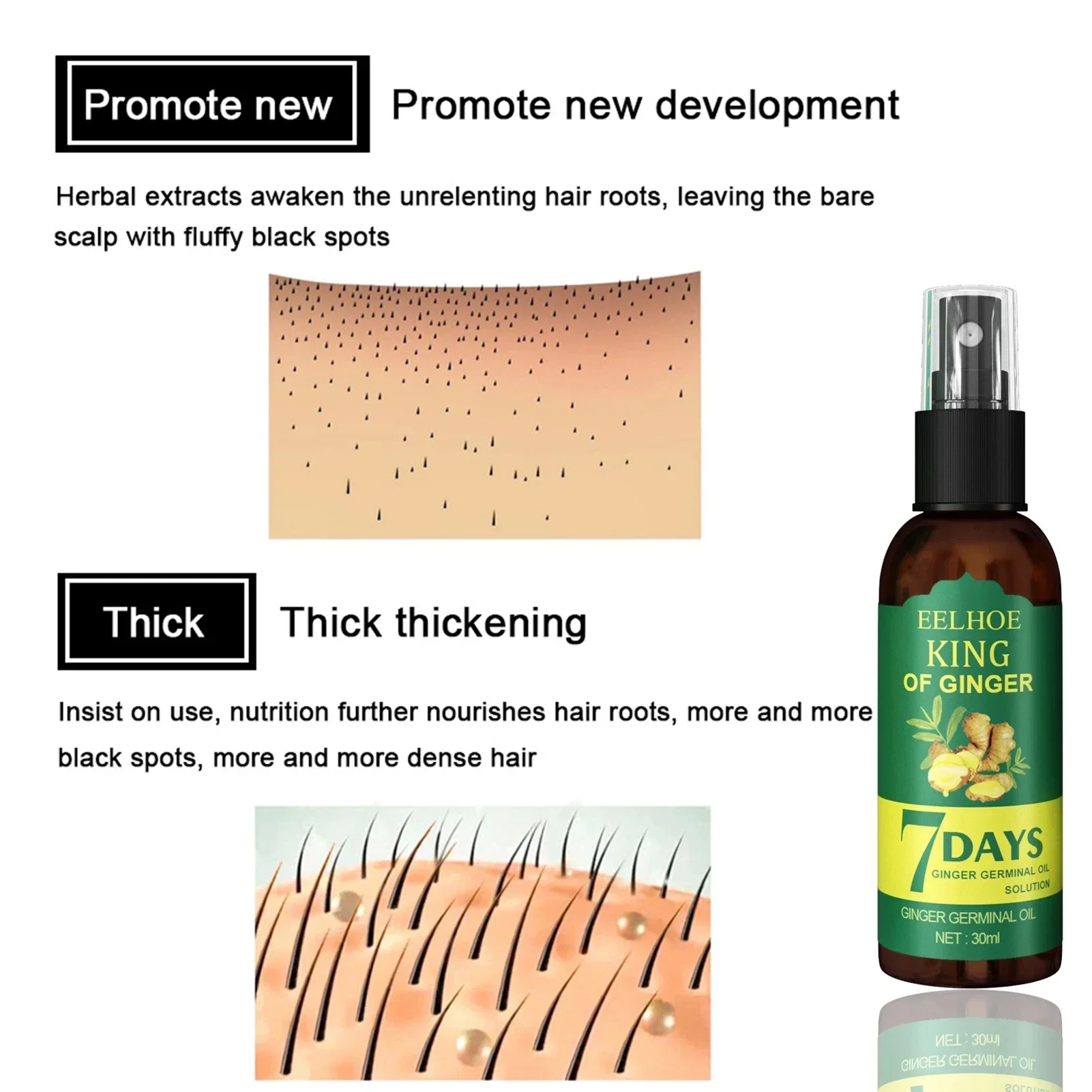 2024 Ginger Hair Growth Serum  - Epidermal Growth Factor recension och pris