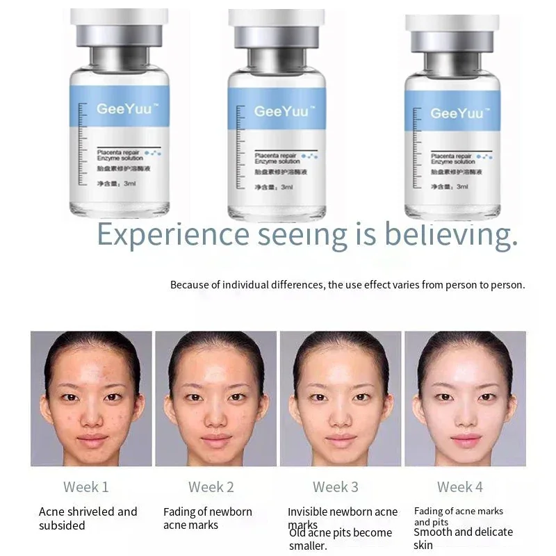 Polypeptide Placenta Freeze-dr - Epidermal Growth Factor recension och pris