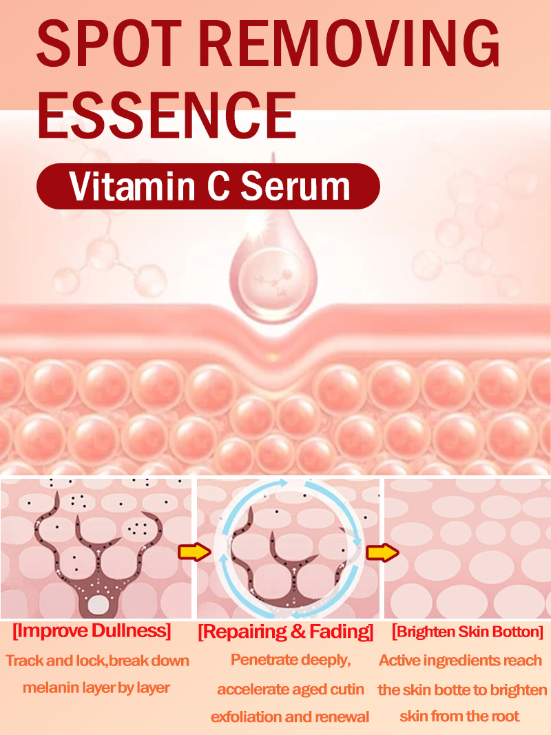 Lighten Freckles Melasma, Faci - Luxury Skincare Essence recension och pris