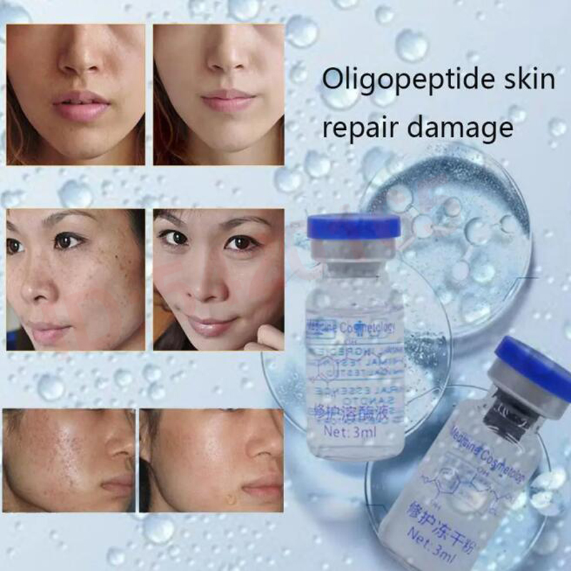 oligopeptide Freeze-dried Powd - Epidermal Growth Factor recension och pris